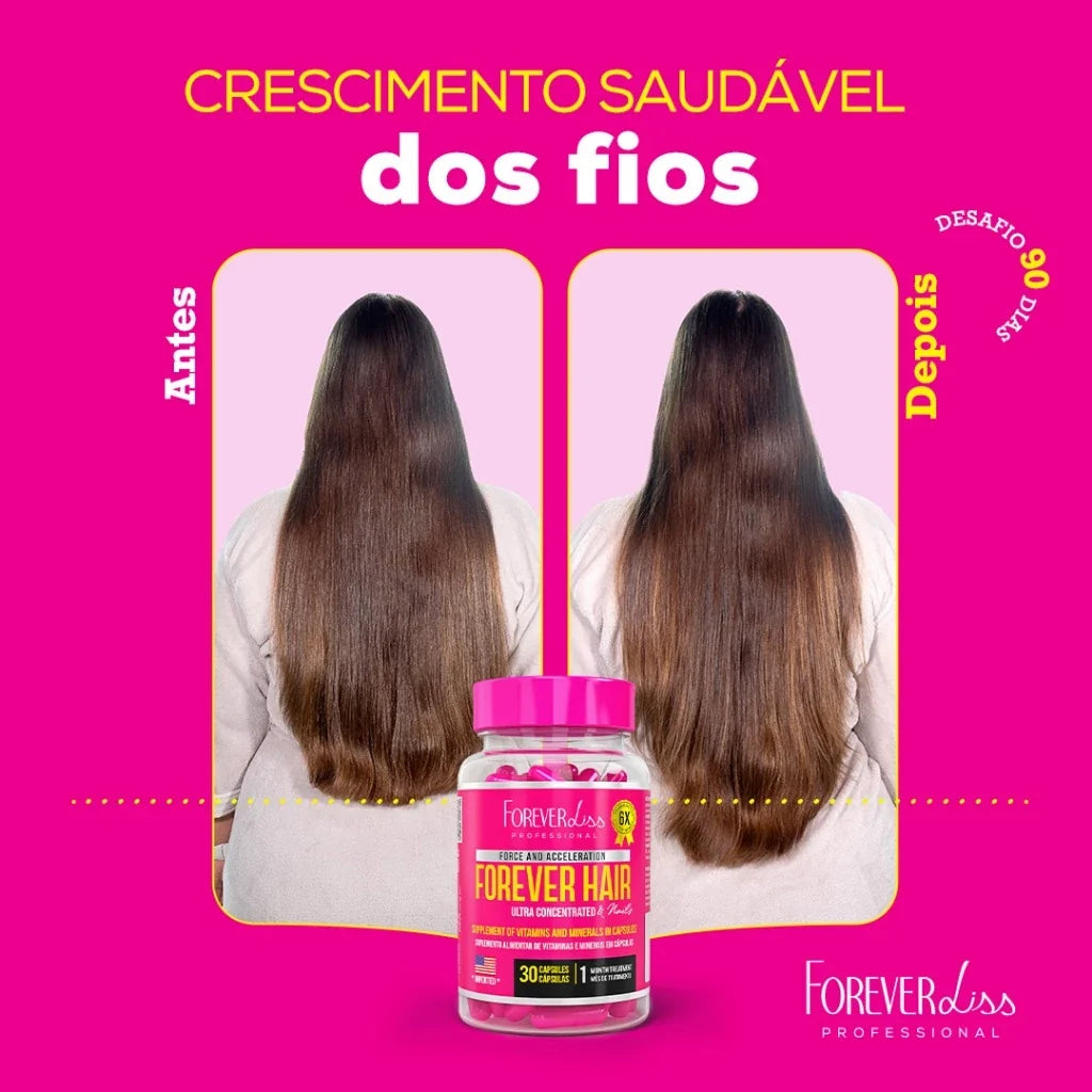 Forever Hair Crescimento Capilar Tratamento 30 Dias