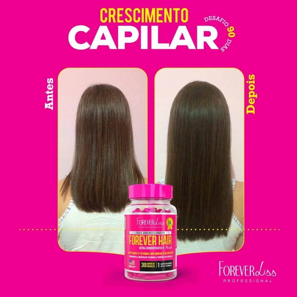 Forever Hair Crescimento Capilar Tratamento 30 Dias