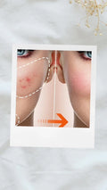 Creme Facial Anti-Acne com Ácido Salicílico para Remover Óleo e Cabeça Preta, Clareador de Cicatrizes